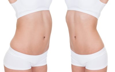 Achieving Your Desired Contour: The Appeal of Liposuction in Boston, MA