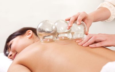 Find Relief with a Cupping Therapy Specialist in Buffalo NY Today