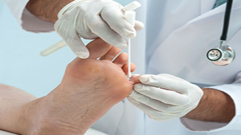 Several Reasons You May Need to Contact a Foot Surgeon
