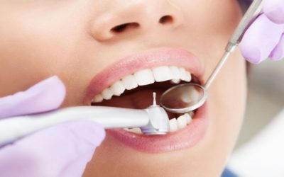 Creating a Bright Smile through Dentist in Chaska, MN