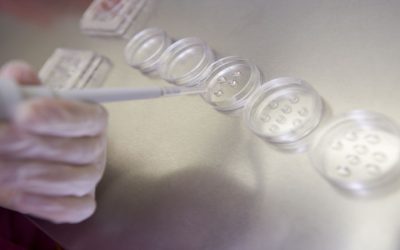 Benefits of Choosing Embryo Transfer Aliso Viejo CA for Your Fertility Journey